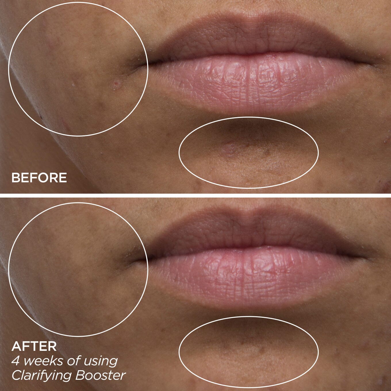Clarifying Booster