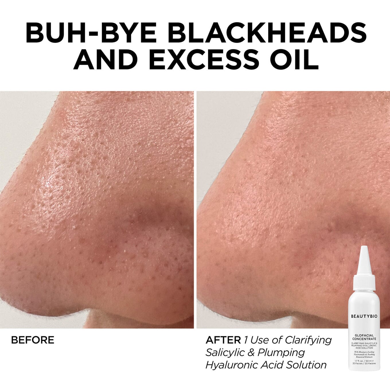 Golden Glow Hydration Facial