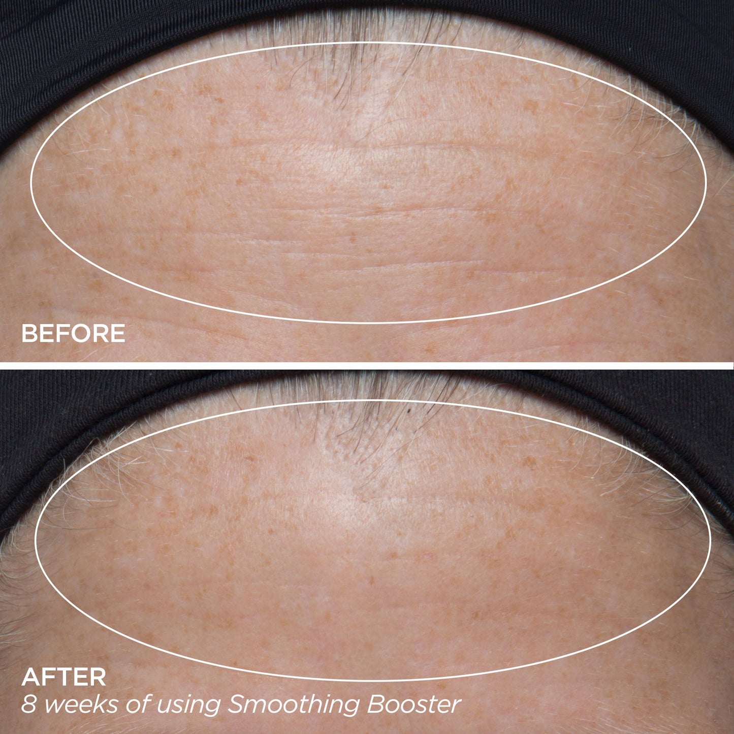 Smoothing Booster