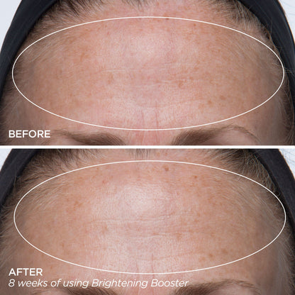 Brightening Booster