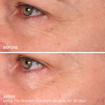 The Quench | Eye Balm