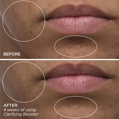 Clarifying Booster