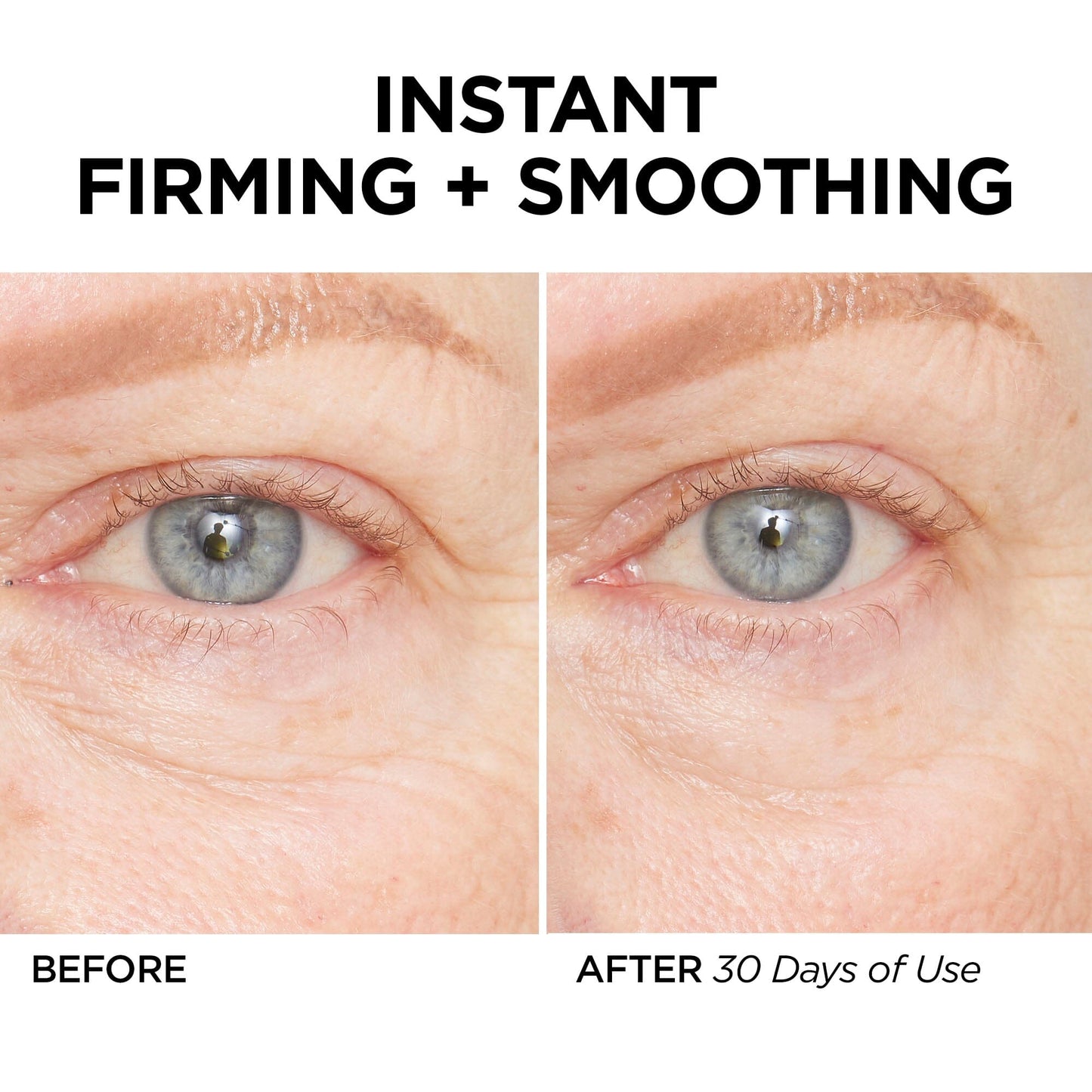 GLOfacial