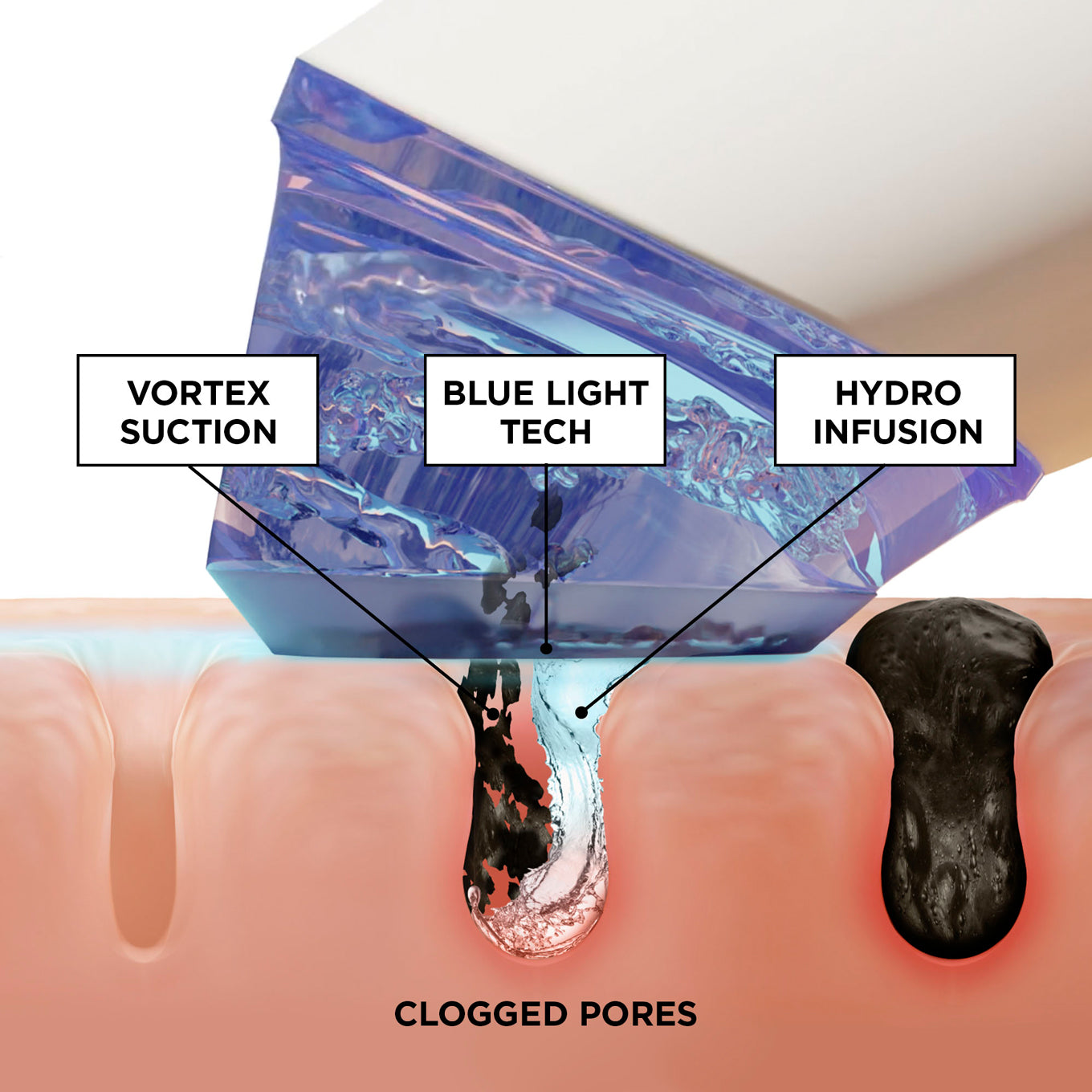 GLOfacial