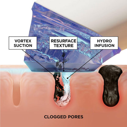 Golden Glow Hydration Facial