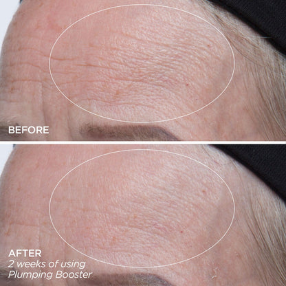 Plumping Booster