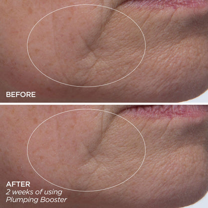 Plumping Booster
