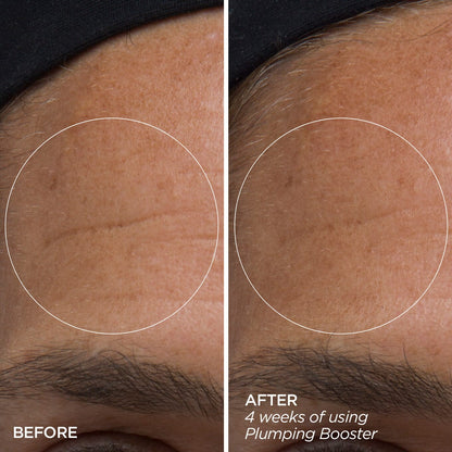 Plumping Booster